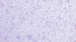 Protein with Activity 1——MCSF1 (Colony Stimulating Factor 1, Macrophage)