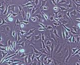 Colon Carcinoma Cells