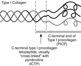 Cross Linked C-Telopeptide Of Type I Collagen (CTXI)