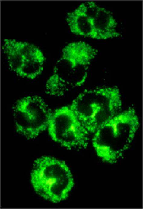 Perinuclear Anti-Neutrophil Cytoplasmic Antibody (pANCA)