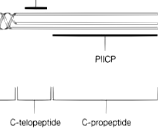 Procollagen II C-Terminal Propeptide (PIICP)