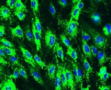 Prostate Microvascular Endothelial Cells (PrMEC)