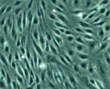 Pulmonary Microvascular Endothelial Cells (PMEC)