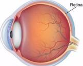 Retinal Ischemia Reperfusion Injury (RIRI)