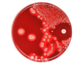Staphylococcus Aureus (S. aureus)
