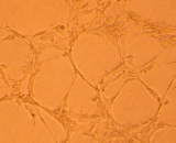 Umbilical Vein Endothelial Cells (UVEC)
