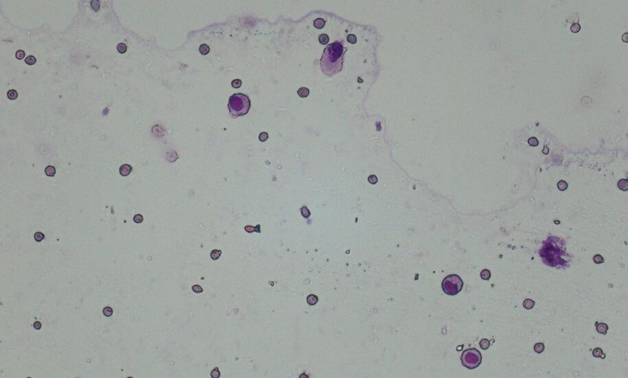 Diff-Quik staining and cell counting