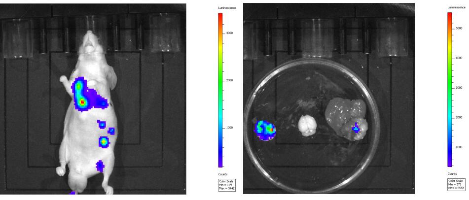 In Vivo Imaging Detection-Tumor Metastasis