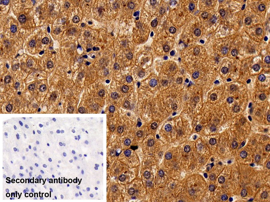 Monoclonal Antibody to Activated Leukocyte Cell Adhesion Molecule (ALCAM)