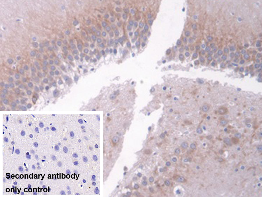 Monoclonal Antibody to Interferon Alpha (IFNa)