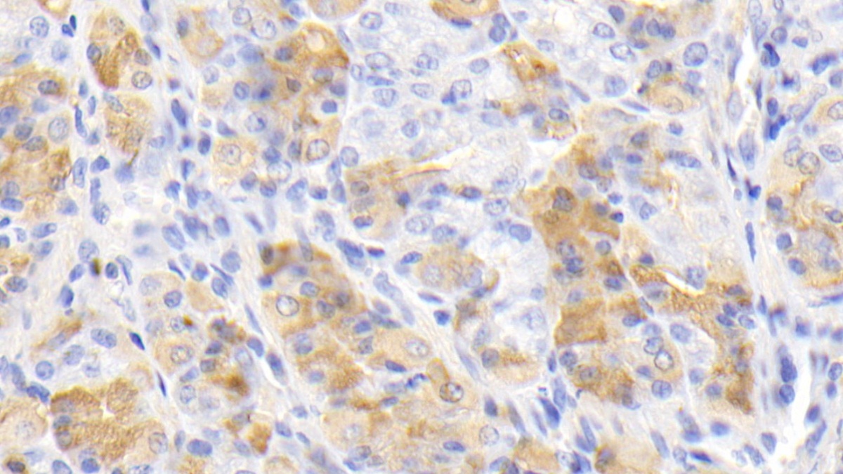 Monoclonal Antibody to Interleukin 12B (IL12B)