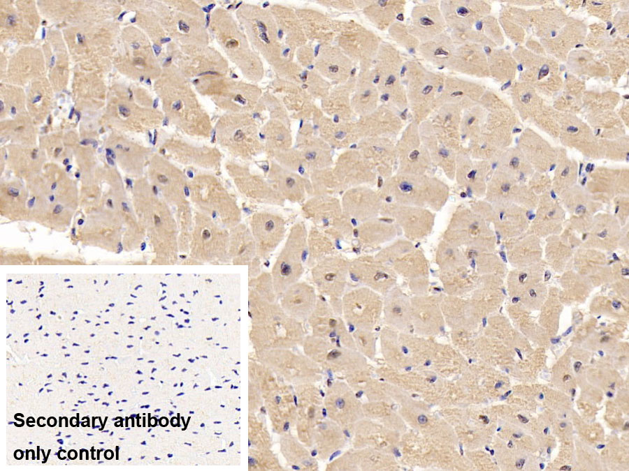 Monoclonal Antibody to Interleukin 6 (IL6)