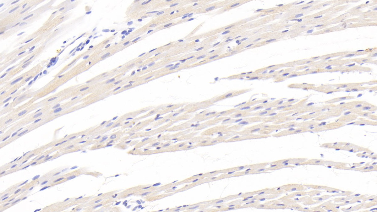 Monoclonal Antibody to Transforming Growth Factor Beta 1 (TGFb1)