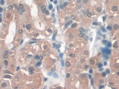 Monoclonal Antibody to Pepsinogen A (PGA)