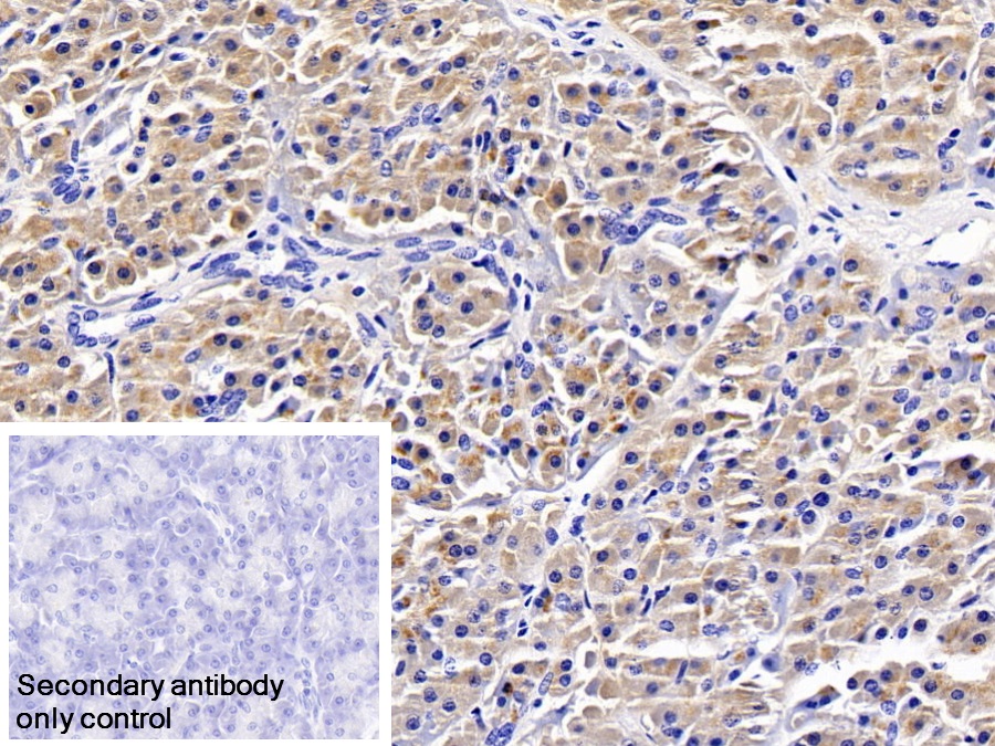 Monoclonal Antibody to Trypsin (TRY)