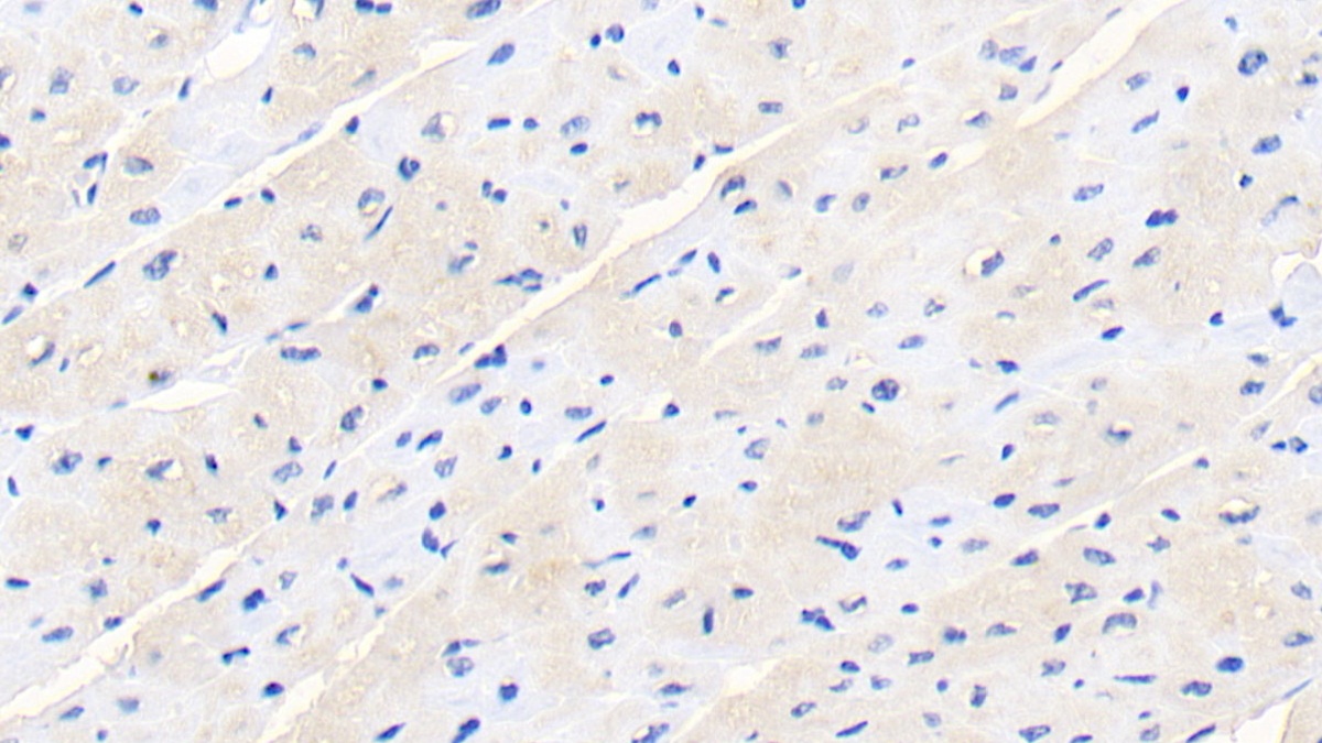 Monoclonal Antibody to Galectin 1 (GAL1)