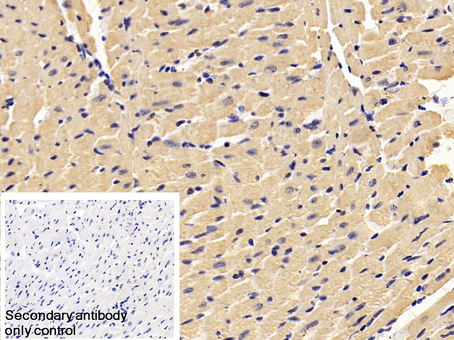 Monoclonal Antibody to Brain Natriuretic Peptide (BNP)