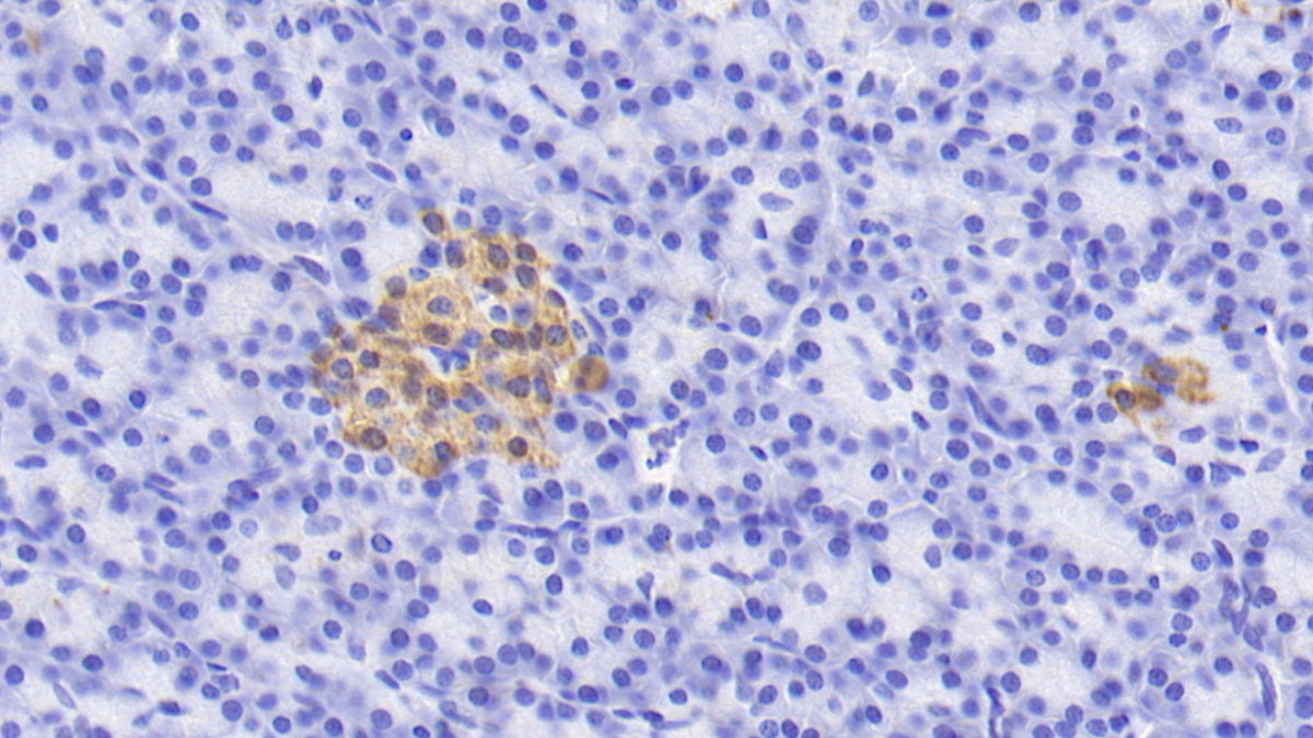 Monoclonal Antibody to Caspase 9 (CASP9)
