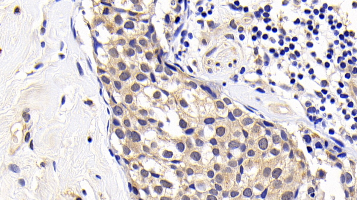 Monoclonal Antibody to B-Cell Leukemia/Lymphoma 2 (Bcl2)