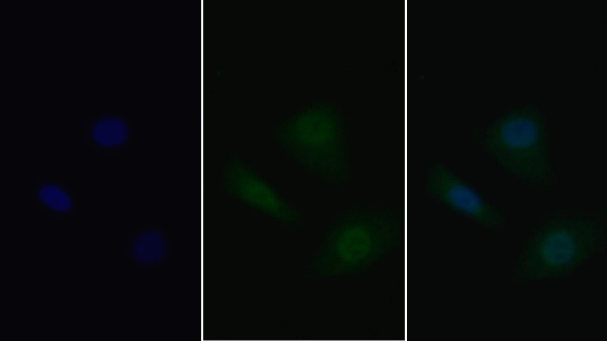 Monoclonal Antibody to Tumor Protein p53 (P53)