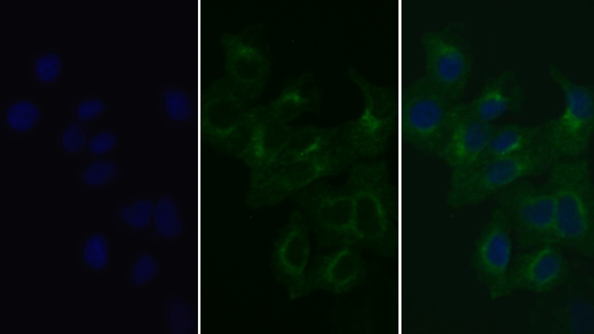 Monoclonal Antibody to Transferrin Receptor (TFR)