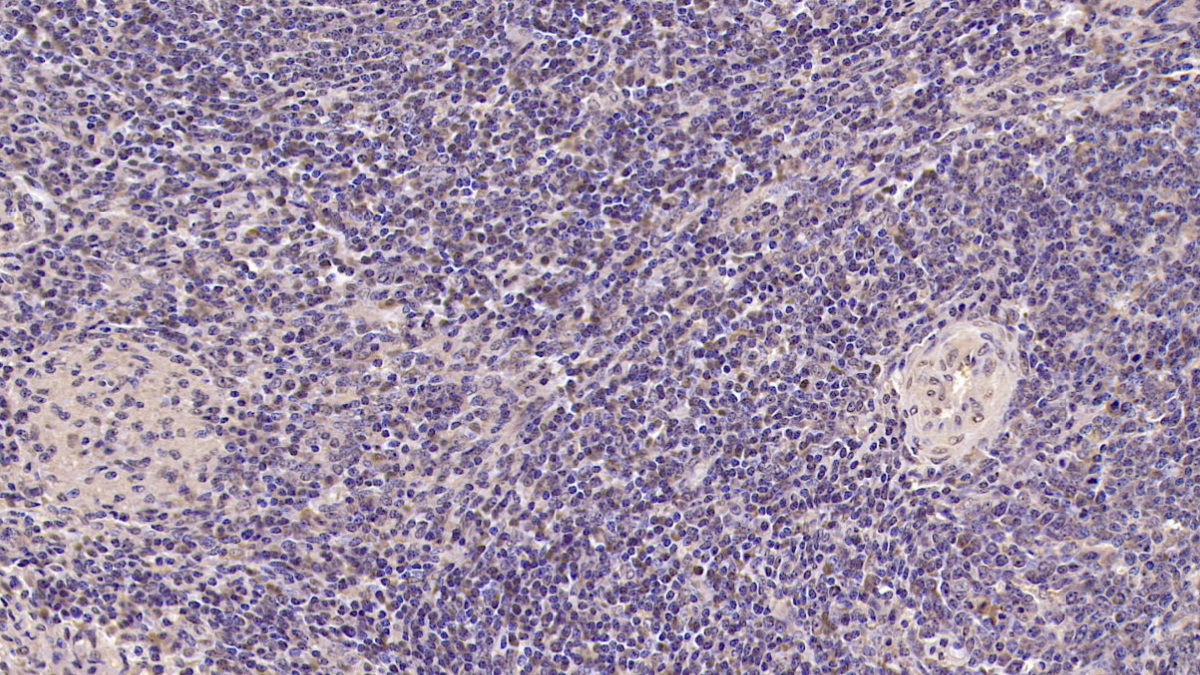 Monoclonal Antibody to Tumor Necrosis Factor Receptor Superfamily, Member 5 (CD40)