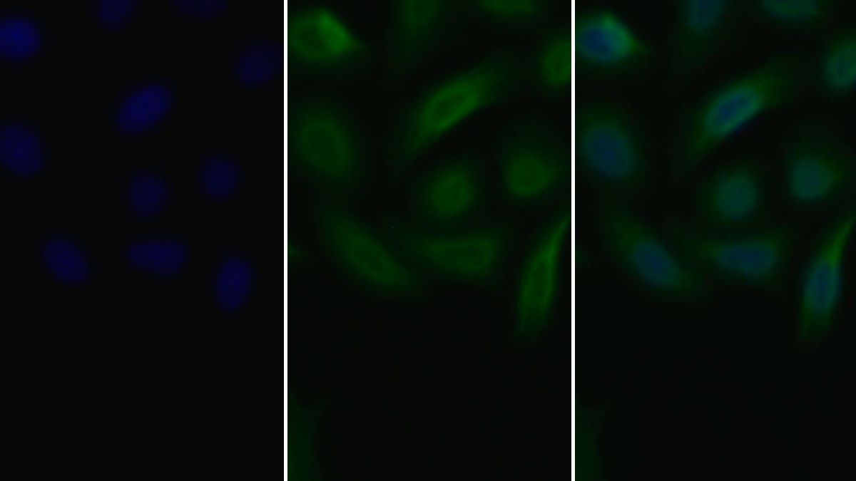 Monoclonal Antibody to Vascular Endothelial Growth Factor Receptor 2 (VEGFR2)