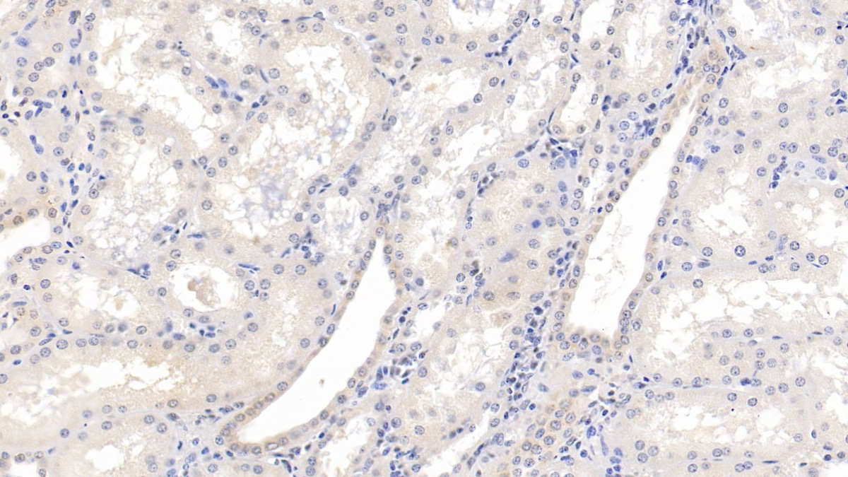 Monoclonal Antibody to Squamous Cell Carcinoma Antigen 1/2 (SCCA1/SCCA2)