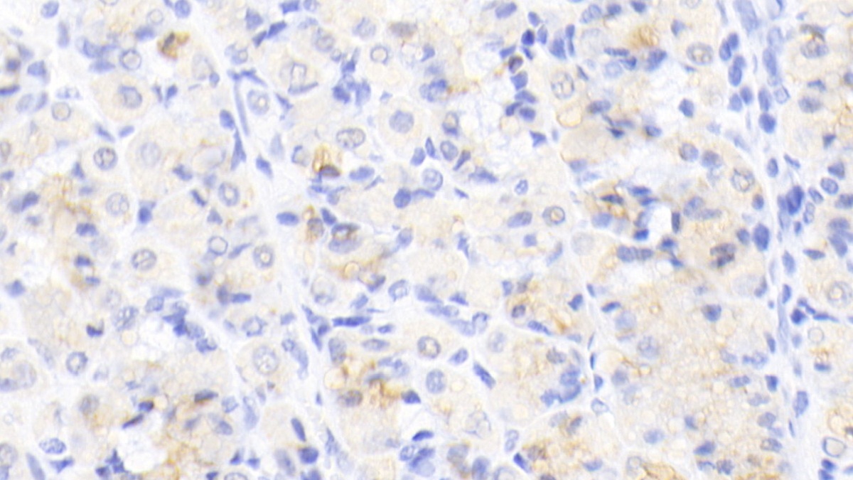 Monoclonal Antibody to Activin A Receptor Type II A (ACVR2A)