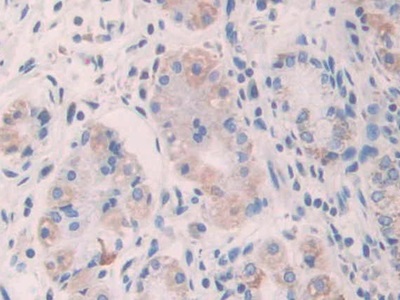 Monoclonal Antibody to Anterior Gradient 2 (AGR2)