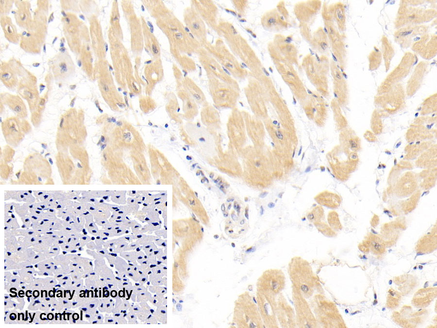 Monoclonal Antibody to Troponin T Type 2, Cardiac (TNNT2)