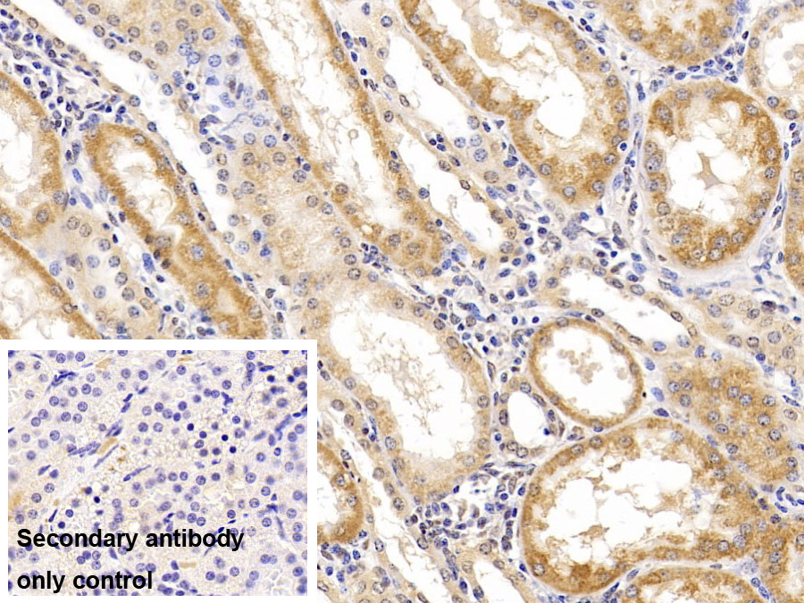 Monoclonal Antibody to Arginase II (Arg2)