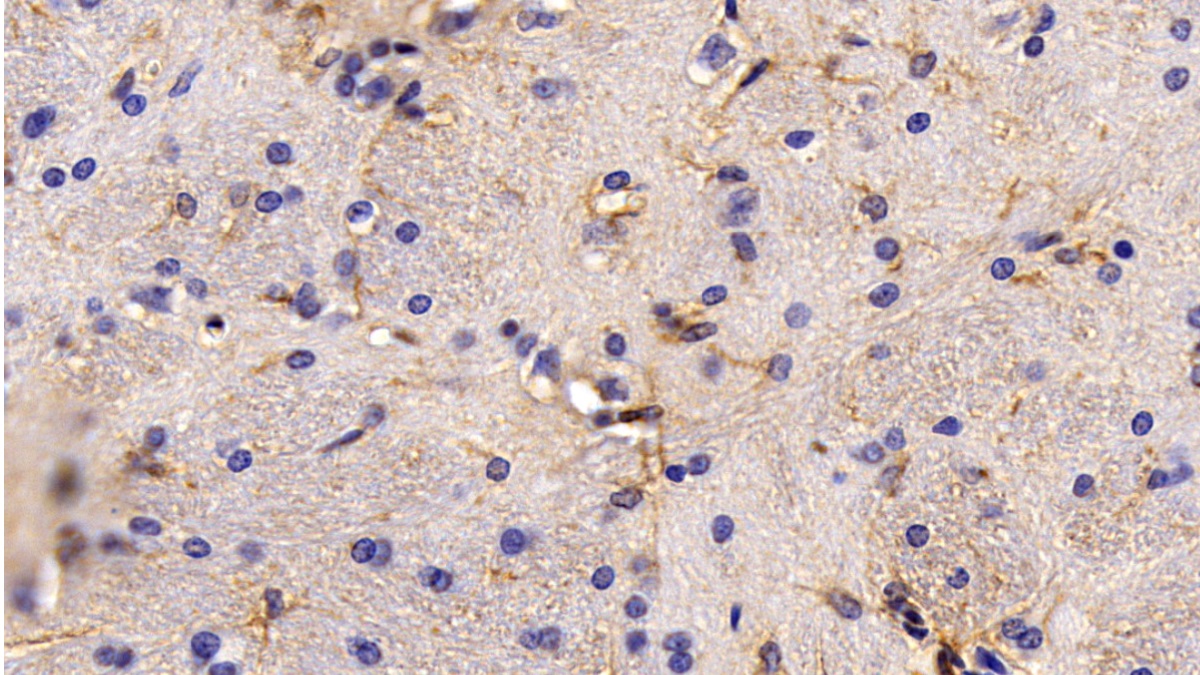 Monoclonal Antibody to Glioblastoma Expressed Ring Finger Protein (GERP)