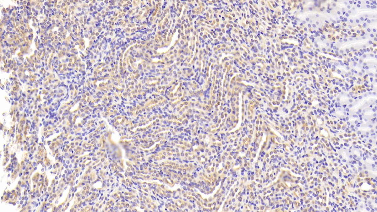 Polyclonal Antibody to Cluster Of Differentiation 33 (CD33)