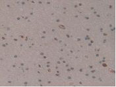 Polyclonal Antibody to Colony Stimulating Factor 2, Granulocyte Macrophage (GM-CSF)