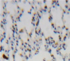 Polyclonal Antibody to Monocyte Chemotactic Protein 1 (MCP1)