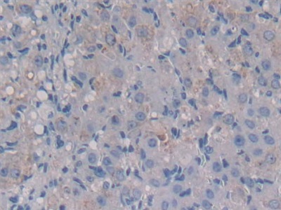 Polyclonal Antibody to Colony Stimulating Factor 1, Macrophage (MCSF)
