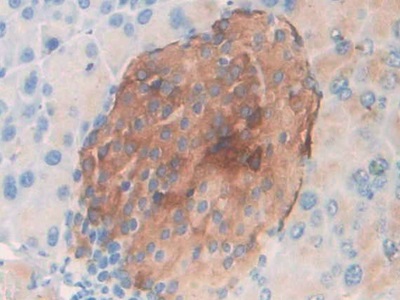 Polyclonal Antibody to Macrophage Inflammatory Protein 3 Alpha (MIP3a)