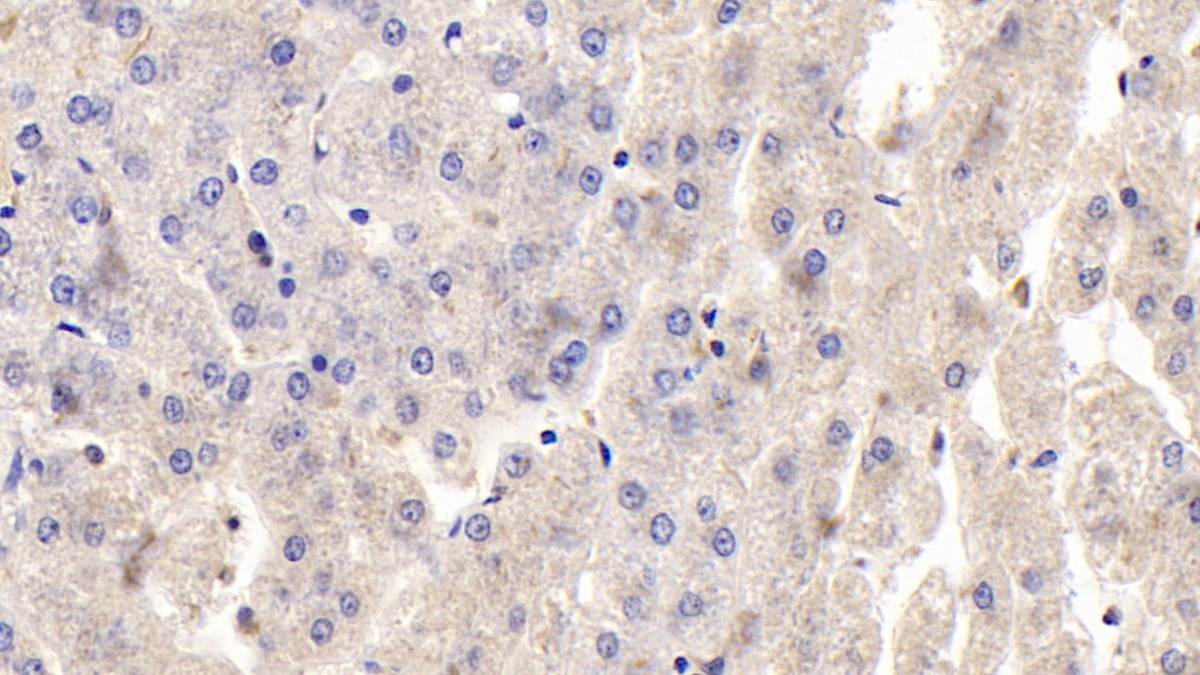Polyclonal Antibody to Osteoprotegerin (OPG)