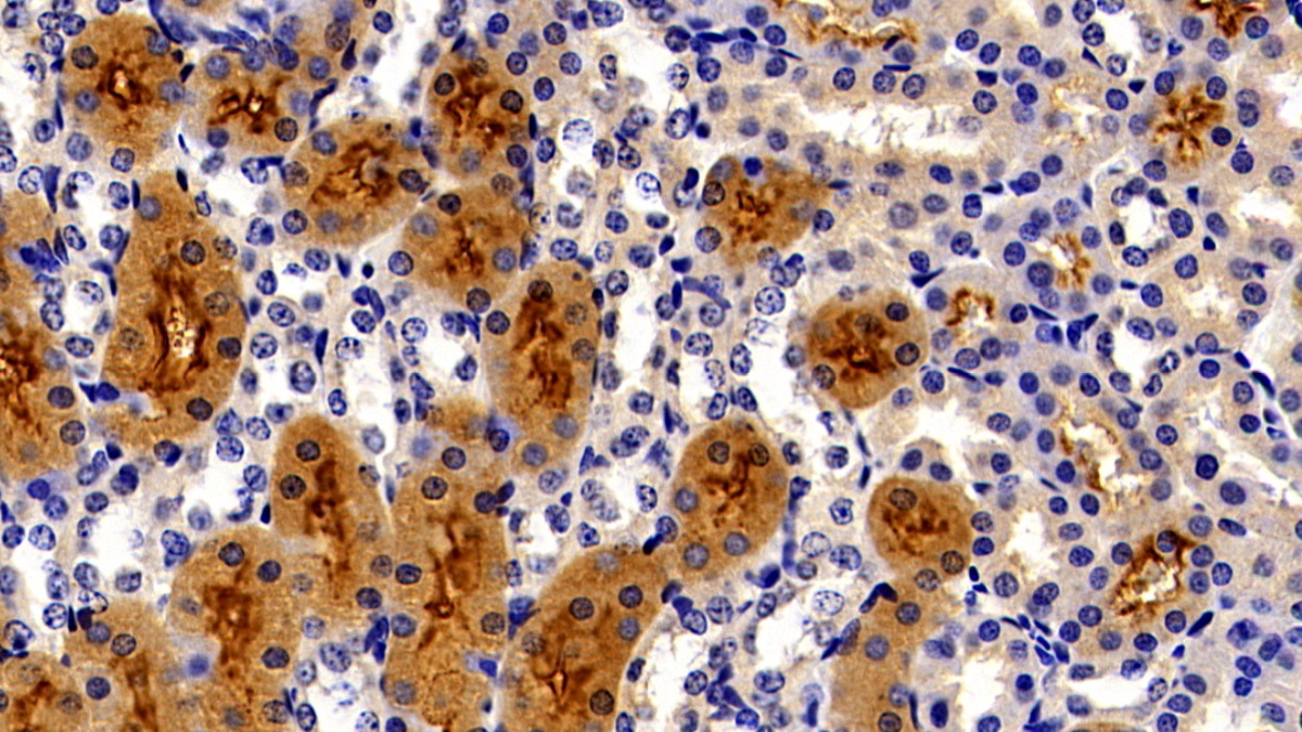 Polyclonal Antibody to Meprin A Alpha (MEP1a)