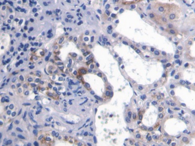 Polyclonal Antibody to Platelet/Endothelial Cell Adhesion Molecule (PECAM1)