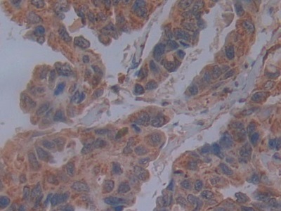 Polyclonal Antibody to Cadherin, Retinal (RCAD)