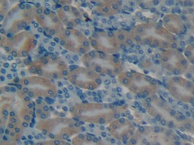 Polyclonal Antibody to Osteocalcin (OC)