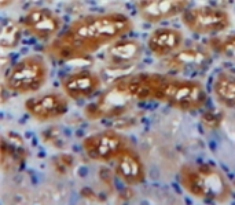 Polyclonal Antibody to Platelet Derived Growth Factor AA (PDGFAA)
