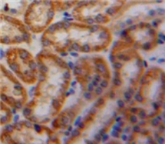 Polyclonal Antibody to Platelet Derived Growth Factor AA (PDGFAA)