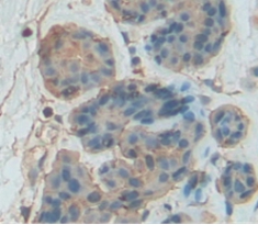Polyclonal Antibody to Granzyme B (GZMB)
