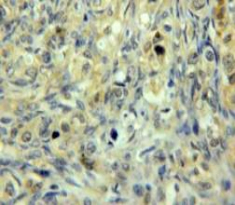 Polyclonal Antibody to Glutathione S Transferase Mu 3, Brain (GSTm3)