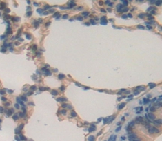 Polyclonal Antibody to Mucin 5 Subtype B (MUC5B)