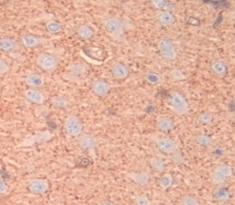 Polyclonal Antibody to Neuropilin 1 (NRP1)