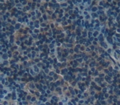 Polyclonal Antibody to Complement Receptor 2 (CD21)